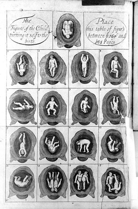 Mellificium chirurgiae. Or, the marrow of chirurgery. An anatomical treatise / Institutions of physick, with Hippocrates's Aphorisms largely commented upon. The marrow of physick, shewing the causes, signs and cures of most diseases incident to human bodies. Choice experienced receits for the cure of several distempers. Illustrated in its several parts with twelve brass cuts.