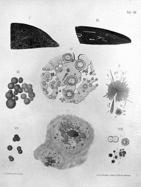 Atlas of pathological anatomy : illustrative of a clinical treatise on diseases of the liver / by Fried. Theod. Frerichs ; translated and edited by Charles Murchison.