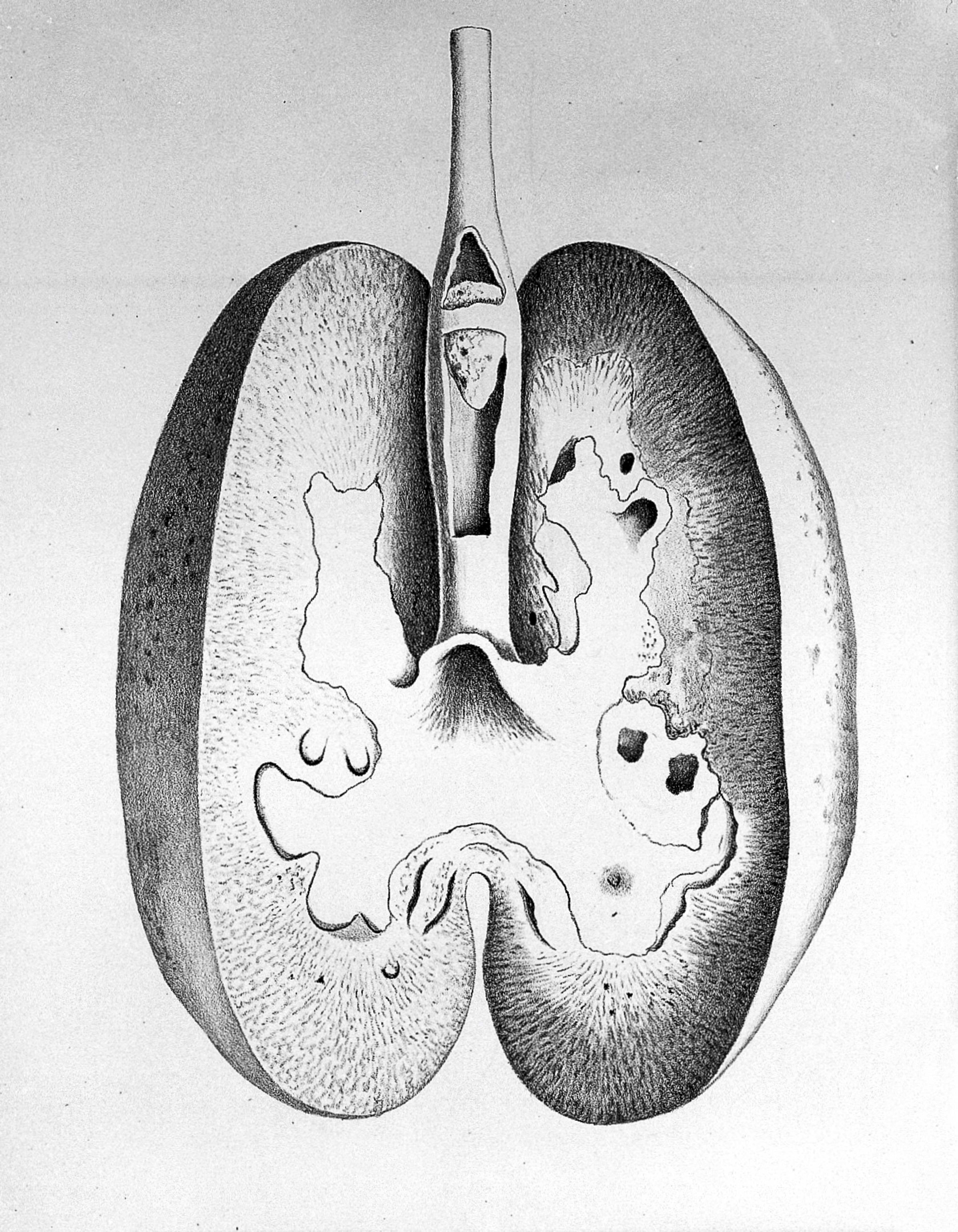 A treatise on the formation, constituents, and extraction of the urinary calculus. Being the essay for which the Jacksonian prize for the year 1833 was awarded by the Royal College of Surgeons in London / by John Green Crosse.