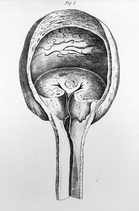 A treatise on the formation, constituents, and extraction of the urinary calculus. Being the essay for which the Jacksonian prize for the year 1833 was awarded by the Royal College of Surgeons in London / by John Green Crosse.