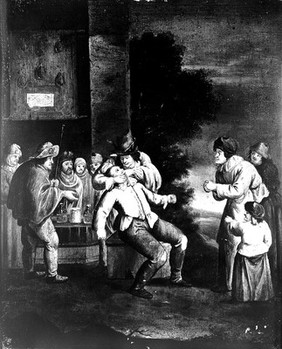 A tooth-drawer extracting tooth from the mouth of a man