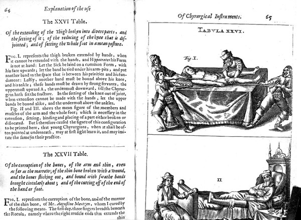 Scultetus "The chyrurgeons...", 1674: table