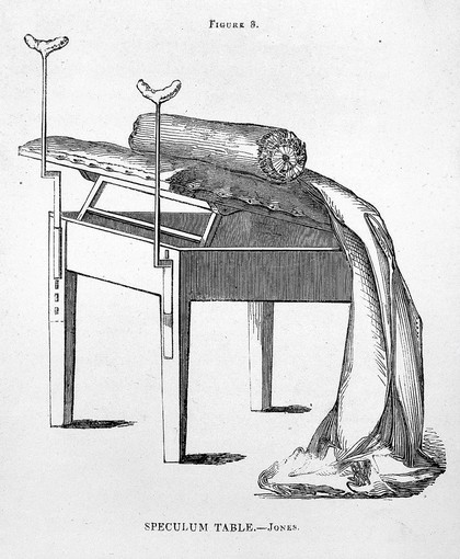 Practical observations on diseases of women / by William Jones.