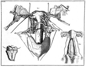 view Uterus