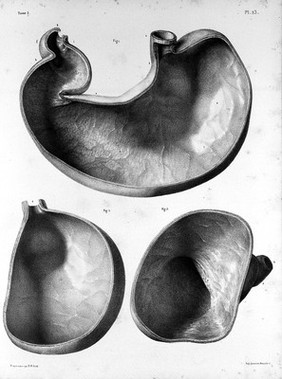 Traité complet de l'anatomie de l'homme comprenant la médecine opératoire ... : avec planches lithographiées ... / par N.H. Jacob.