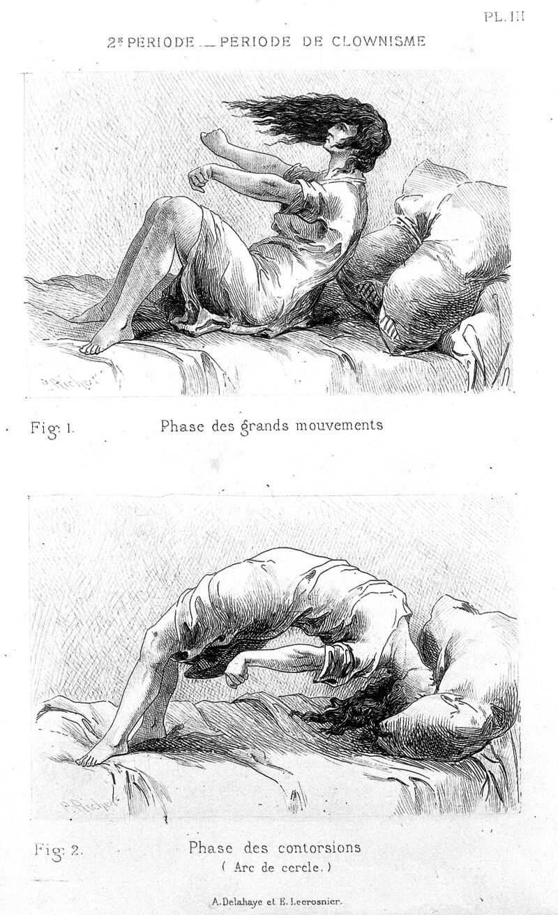 no text alternative