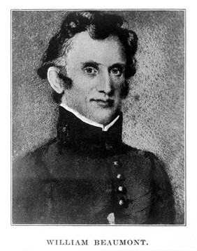 Experiments and observations on the gastric juice, and the physiology of digestion / by William Beaumont ; Facsim. of the original ed. of 1833 together with a biographical essay A pioneer American physiologist, by Sir William Osler.