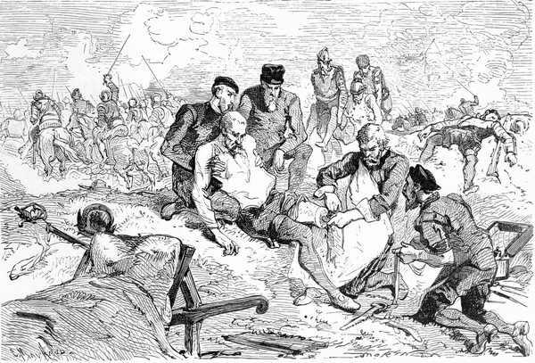 Ambroise Paré, on the battlefield using a ligature for the artery of an amputated leg of a soldier. Wood engraving by Charles Maurand after E. Morin.