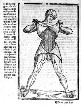 Carpi commentaria cũm amplissimis additionibus super Anatomia Mũndini vna cum textu eiusdẽm in pristinũm et verum nitorèm redacto / [Jacopo Berengario da Carpi].