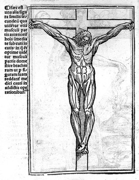 Carpi commentaria cũm amplissimis additionibus super Anatomia Mũndini vna cum textu eiusdẽm in pristinũm et verum nitorèm redacto / [Jacopo Berengario da Carpi].