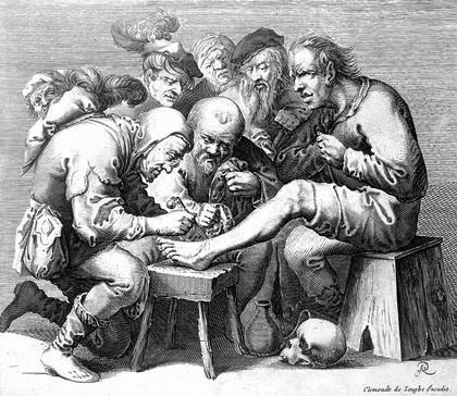 An operator treating a patient's foot; a crowd of people is gathered around watching the work. Line engraving by P. Quast.