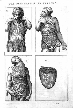 Historia de la composicion del cuerpo humano / Escrita por loan de Valuerde de Hamusco.