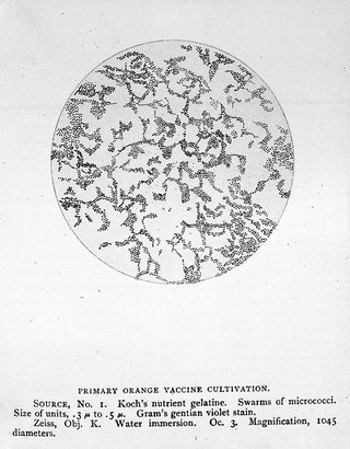Vaccinia and variola : a study of their history / by John B. Buist.