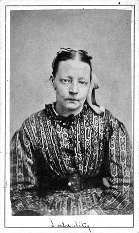 Ellen Sutcliffe, a patient at West Riding Lunatic Asylum, Wakefield, Yorkshire. Photograph attributed to James Crichton-Browne, 1873.