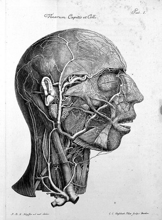 Observationes anatomici. Historia monstri bicorporis duobus capitibus, tribus pedibus, pectore pelvique concreti : curae renovatae de anastomosi tubulorum lactiferorum mammae muliebris, concrementa terrestria, venae capitis et colli cum figuris ad vivum expressis / Joannis Gottlieb Walteri.