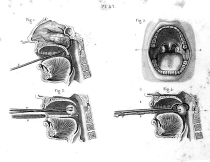 Illustrated manual of operative surgery and surgical anatomy / by Cl. Bernard and Ch. Huette ; edited, with notes and additions, and adapted to the use of the American medical student, by W.H. Van Buren and C.E. Isaacs.