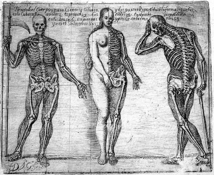 Two skeletons and one half-skeleton, half-female figure, with contours of the overlying body. Etching by J. García Hidalgo, ca. 1691.