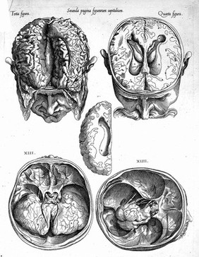 Compendiosa totius anatomiae delineatio aere exarata / [Thomas Geminus].