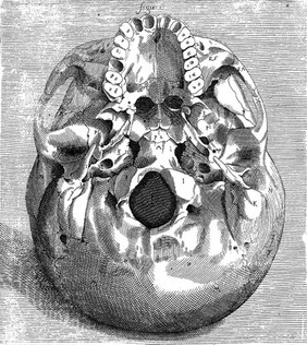 Skull illustration, 16th century, in Volcher Coiter