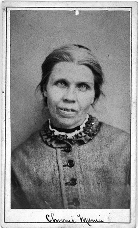 Mary Keighley, a patient at the West Riding Lunatic Asylum, Wakefield, Yorkshire. Photograph attributed to James Crichton-Browne, 1873.