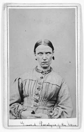Elizabeth Hardcastle, a patient at the West Riding Lunatic Asylum, Wakefield, Yorkshire. Photograph attributed to James Crichton-Browne, 1872.