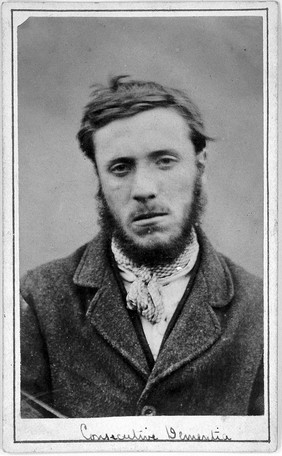 John Edward Gartside, a patient at the West Riding Lunatic Asylum, Wakefield, Yorkshire. Photograph attributed to James Crichton-Browne, 1872.