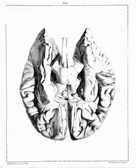 Traité complet de l'anatomie, de la physiologie, et de la pathologie du système nerveux cérébro-spinal ... 1re partie. Anatomie / [Achille Louis Foville].