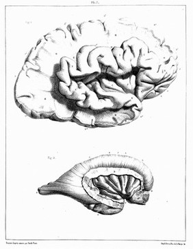 Traité complet de l'anatomie, de la physiologie, et de la pathologie du système nerveux cérébro-spinal ... 1re partie. Anatomie / [Achille Louis Foville].