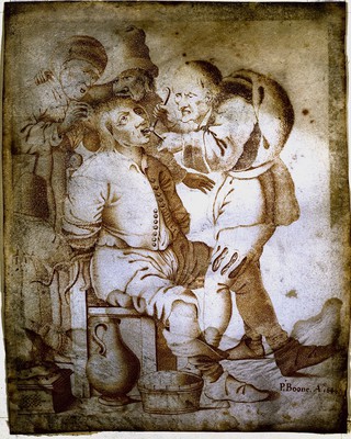 An operator pulling a tooth; representing the sense of touch. Pen and ink drawing by P. Boone, 1649.