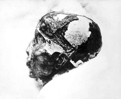 A mummified human skull; inscribed on verso "Tutankh-amen revealed after 3.000 years. Daily Mirror, London, 5th July 1926"