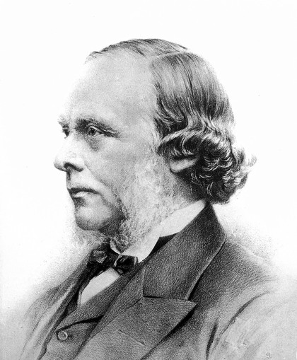 Joseph Lister, 1st Baron Lister. Photograph.