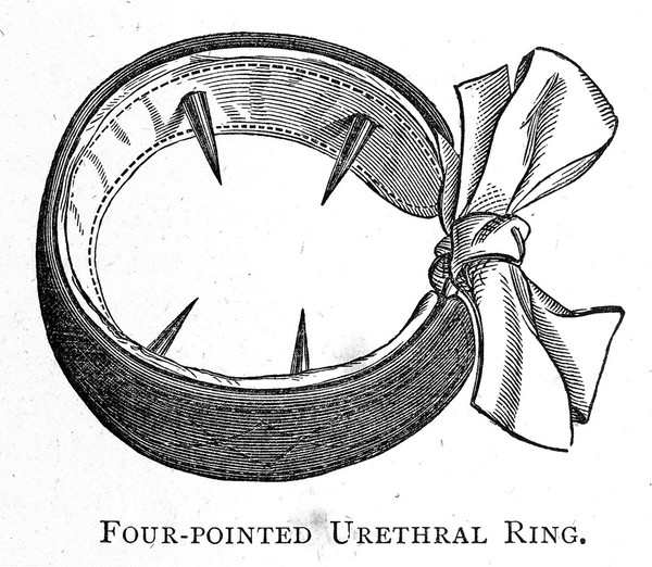 On the pathology and treatment of spermatorrhœa / by J.L. Milton.