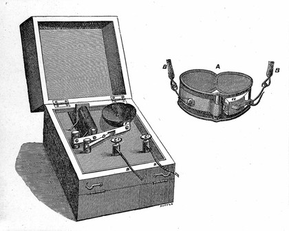 On the pathology and treatment of spermatorrhœa / by J.L. Milton.