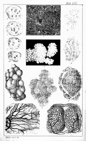 The microscopic anatomy of the human body in health and disease / By Arthur Hill Hassall.