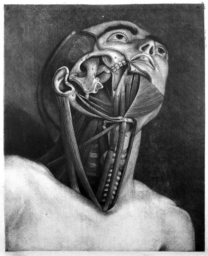 Muscles of the head and neck, the head raised and the lower jaw removed exposing the teeth and the zygomatic arch. Colour mezzotint by J. F. Gautier d'Agoty after himself, 1745-1746.