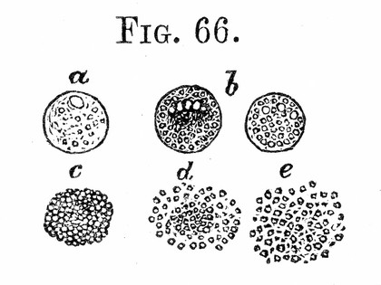 Cellular pathology : as based upon physiological and pathological histology twenty lectures delivered in the Pathological Institute of Berlin during the months of February, March, and April, 1858 / by Rudolf Virchow ; translated from the second edition of the original by Frank Chance ; with notes and numerous emendations, principally from ms. notes of the author.