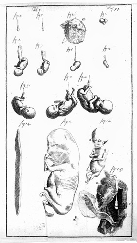 An essay towards a complete new system of midwifry, theoretical and practical. Together with the descriptions, causes and methods of removing, or relieving the disorders peculiar to pregnant ... women, and new-born infants / [John Burton].