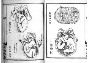 view Chinese manuscript Hsi-i wu-chung.