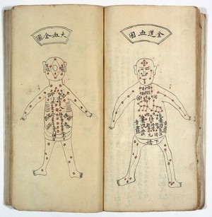 view Recipes on acupuncture, with drawings of the human body.