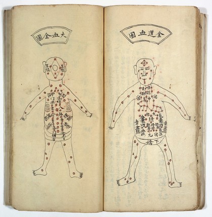 Recipes on acupuncture, with drawings of the human body.
