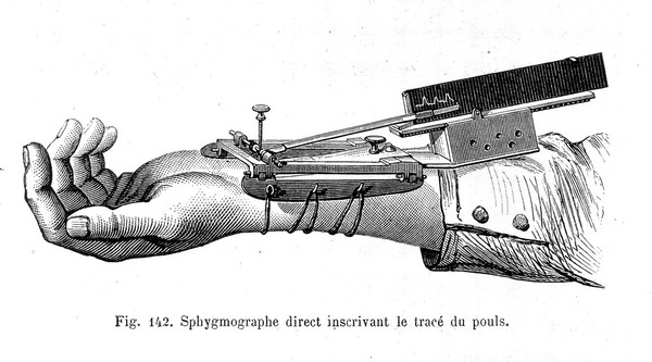 La méthode graphique dans les sciences expérimentales et principalement en physiologie et en médecine / par E.J. Marey.