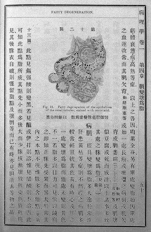 view Fatty degeneration, Dr.P.L. McAll