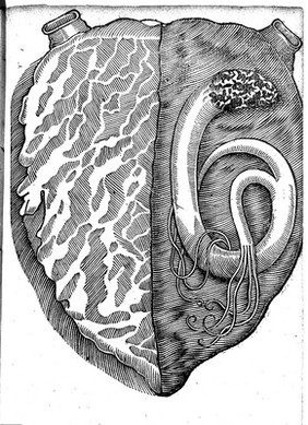 A most certaine and true relation of a strange monster or serpent found in the left ventricle of the heart of John Pennant, Gentleman, of the age of 21 yeares.