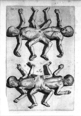 J. Palfyn, Descriptione anatomique des parties de la femme
