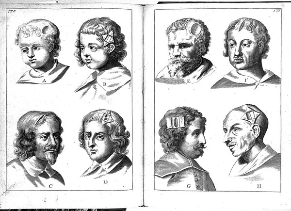 A compleat discourse of wounds : both in general and in particular: whereunto are added the severall fractures of the skull, with their variety of figures. As also a treatise of gunshot-wounds in general / collected and reduced into a new method by John Brown.