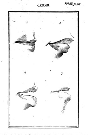 Essays on physiognomy; for the promotion of the knowledge and the love of mankind / Written in the German language by John Caspar Lavater, and translated [from the German] into English by Thomas Holcroft.