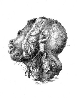 Anatomie de la tête, en tableaux imprimés, qui representent au naturel le cerveau sous différentes coupes, la distribution des vaisseaux ... les organes des sens, et une partie de la névrologie, d'après les pièces disséquées et préparées / par Duverney.