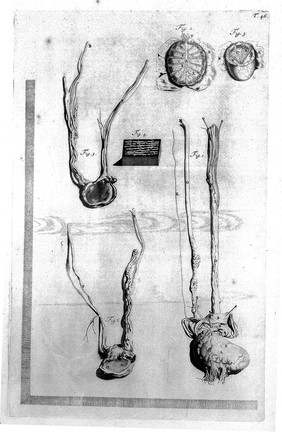 The anatomy of humane bodies, with figures drawn after the life ... by some of the best masters in Europe ... and curiously engraven in one hundred and fourteen copper plates, illustrated with large explications, containing many new anatomical discoveries, and chirurgical observations. To which is added an introduction explaining the animal oeconomy. With a copious index / By William Cowper.