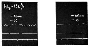 view H. H. Dale, Adventures in physiology...