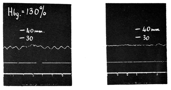 H. H. Dale, Adventures in physiology...